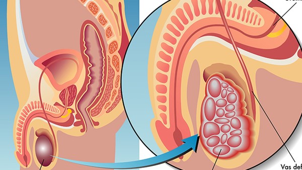 味觉是五脏六腑的“风向标”？不同滋味对应着不同疾病！